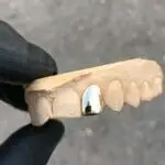 Grillz Oro Lateral