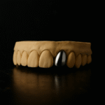 Grillz Cromo Lateral