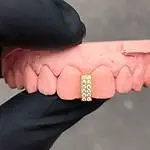 Grillz Diastema Diamantes