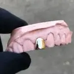 Grillz Oro Lateral