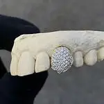 Grillz con diamantes