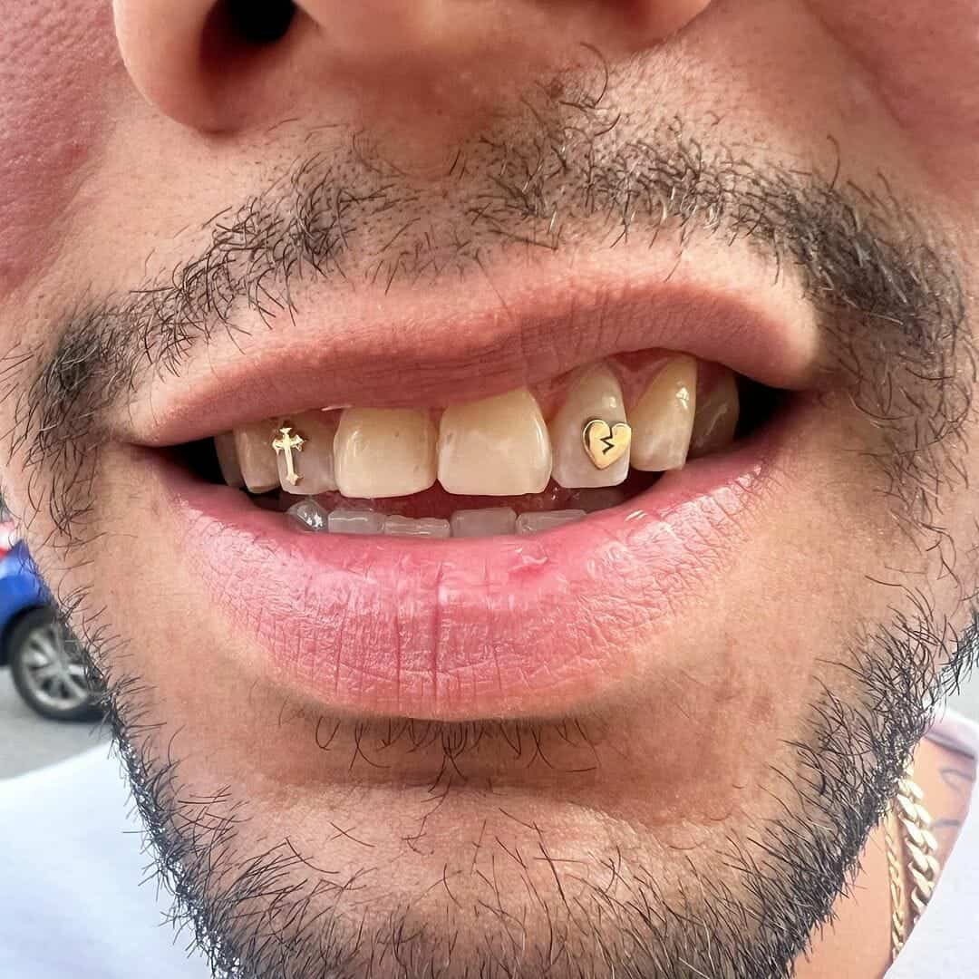 Gemas Dentales