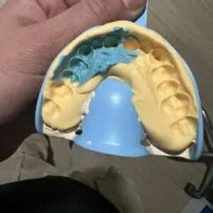 Recepción de moldes