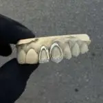 Grillz ventana con diamantes