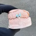 Grillz 2 Piezas Grabado laser a elegir
